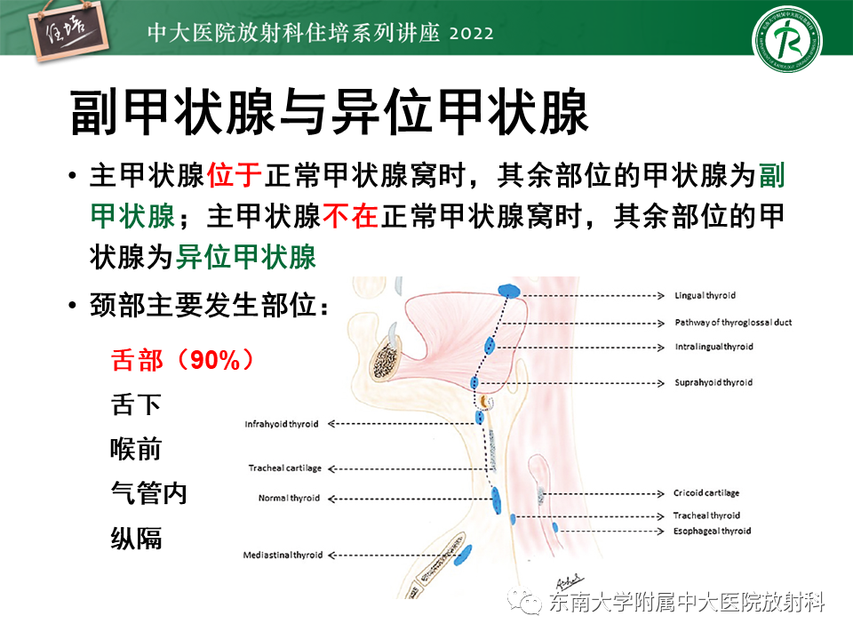影像PPT - 【PPT】甲状腺肿瘤及肿瘤样病变影像诊断与评估-18