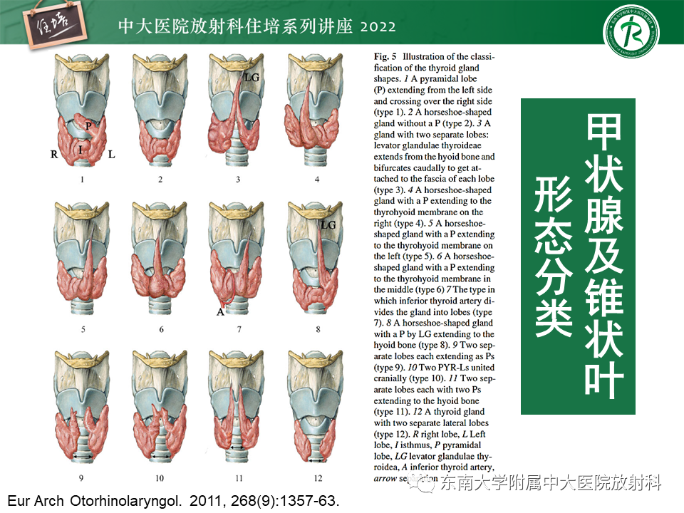 影像PPT - 【PPT】甲状腺肿瘤及肿瘤样病变影像诊断与评估-16