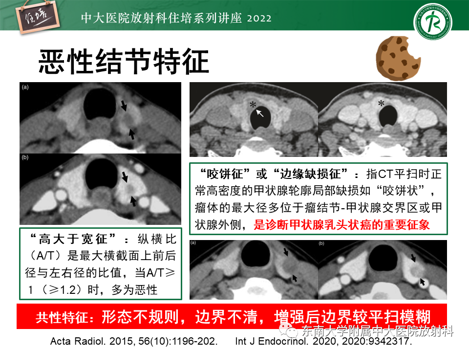 影像PPT - 【PPT】甲状腺肿瘤及肿瘤样病变影像诊断与评估-33