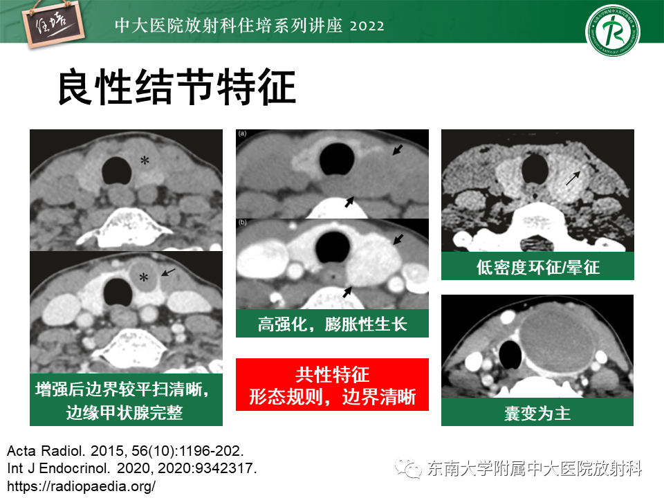 影像PPT - 【PPT】甲状腺肿瘤及肿瘤样病变影像诊断与评估-32