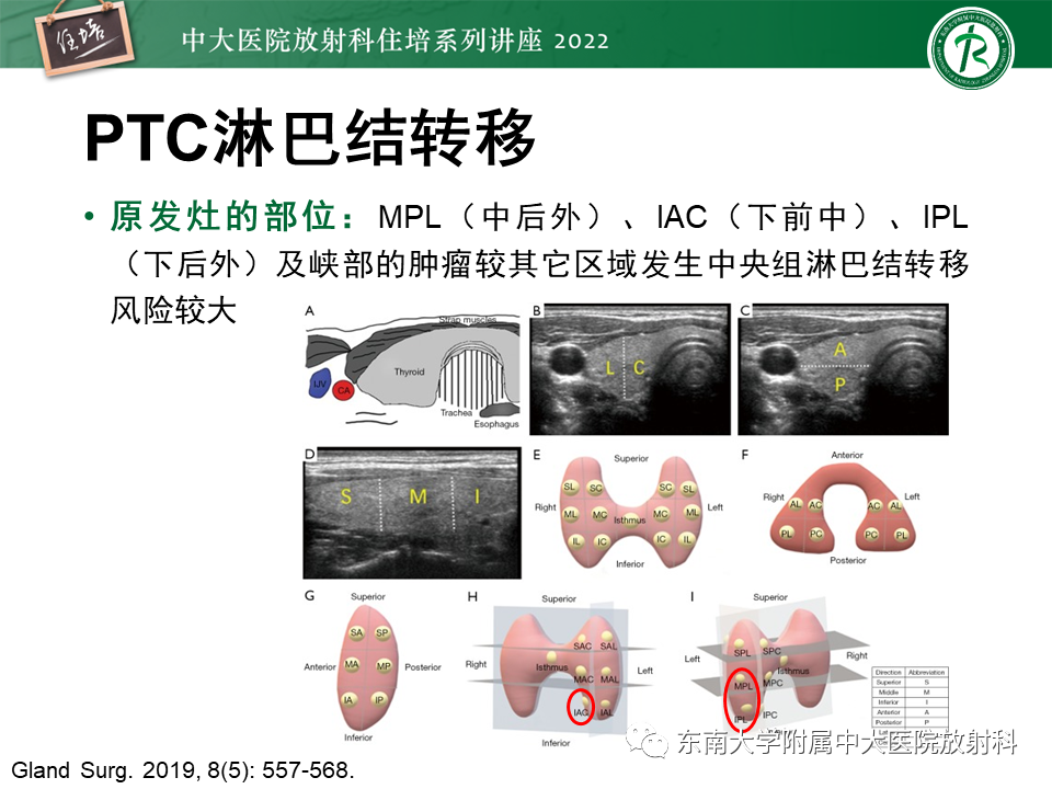 影像PPT - 【PPT】甲状腺肿瘤及肿瘤样病变影像诊断与评估-61