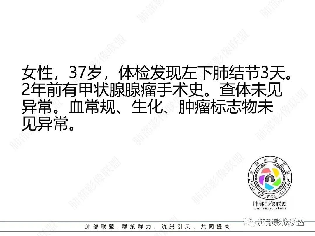 影像PPT - 【病例】年轻女性的肺结节-2 影像PPT - 【病例】年轻女性的肺结节-2