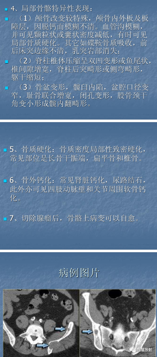 影像PPT - 【病例】棕色瘤1例CT影像表现-14 影像PPT - 【病例】棕色瘤1例CT影像表现-14