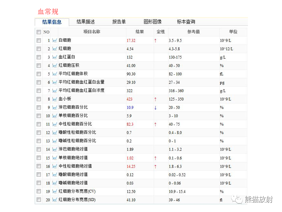 影像PPT - 【病例】肺肉瘤样癌2例CT影像-17