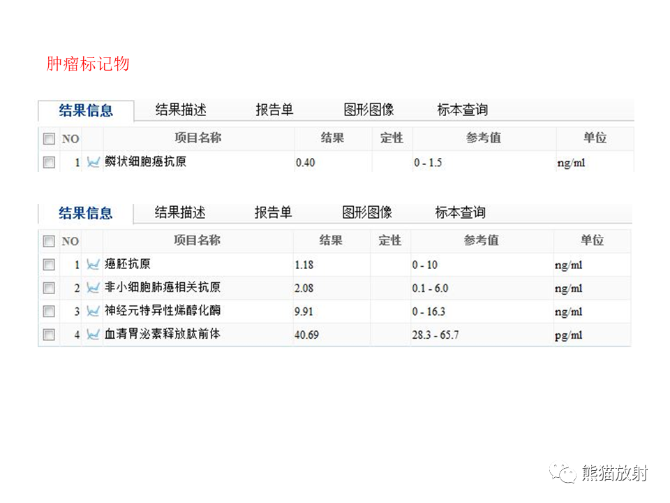 影像PPT - 【病例】肺肉瘤样癌2例CT影像-18