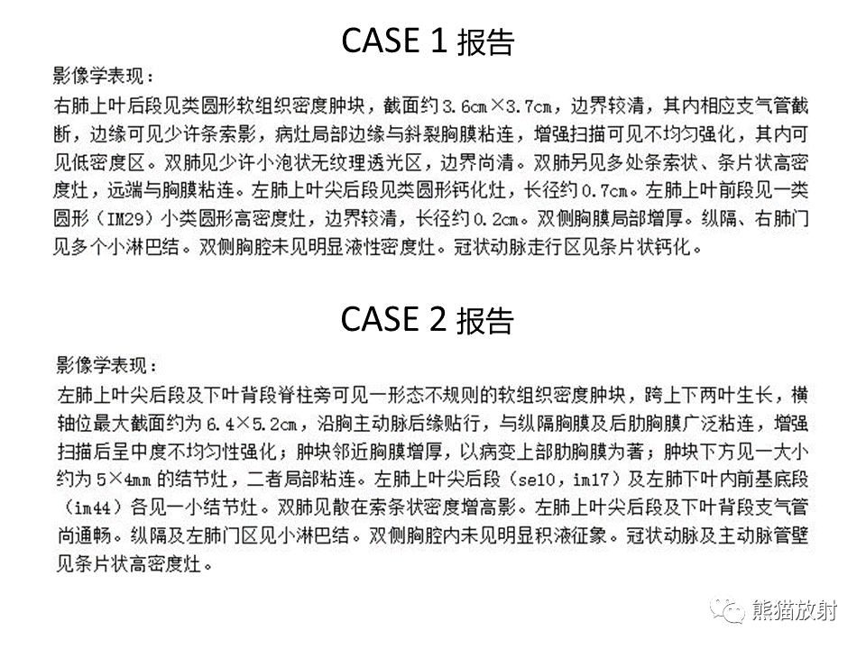 影像PPT - 【病例】肺肉瘤样癌2例CT影像-29