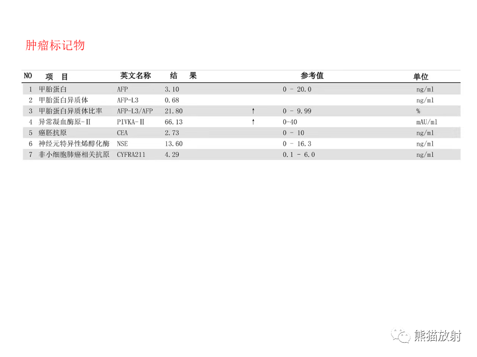 影像PPT - 【病例】肺肉瘤样癌2例CT影像-1