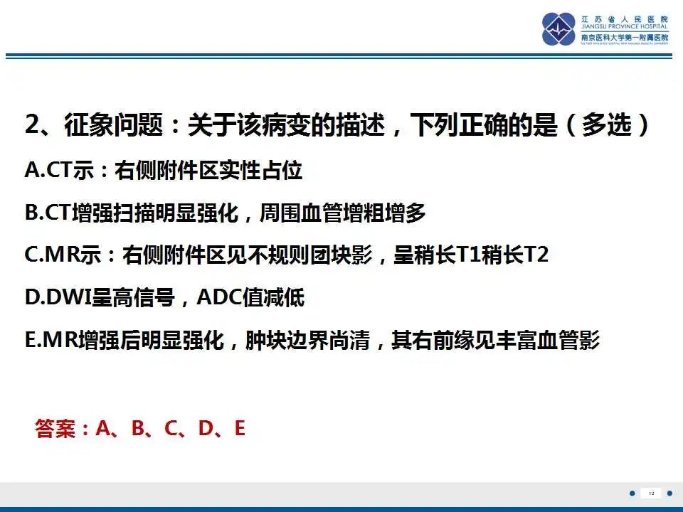 影像PPT - 【PPT】卵巢支持细胞瘤-13
