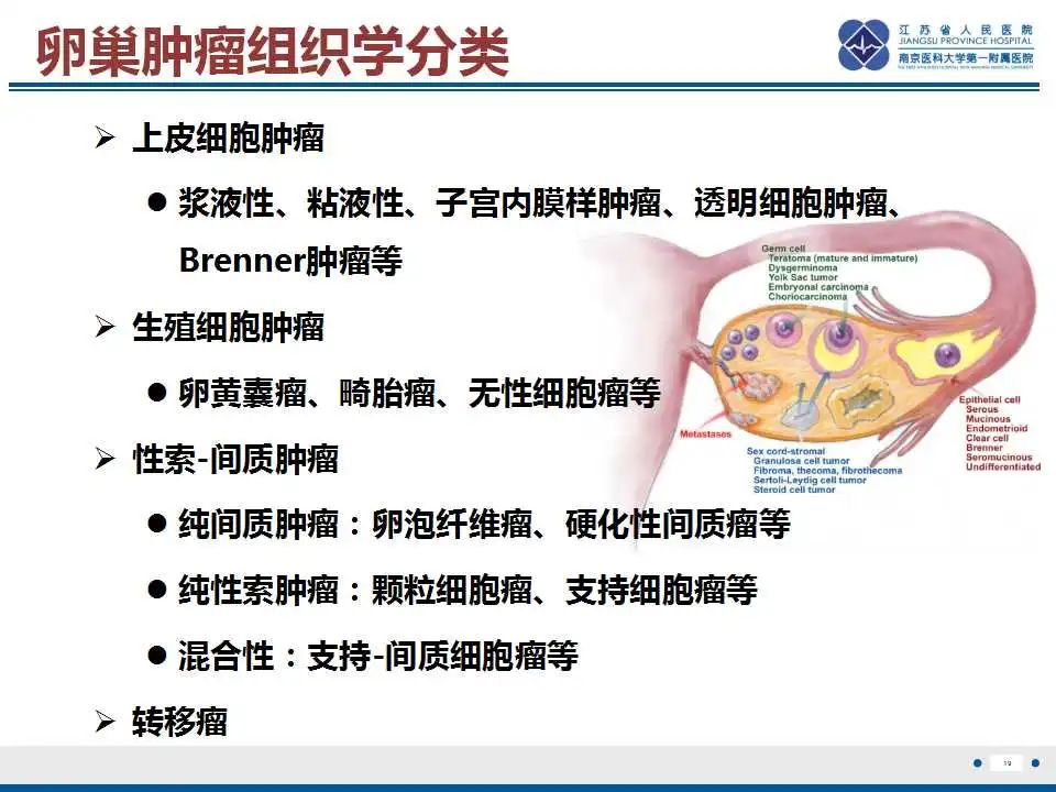 影像PPT - 【PPT】卵巢支持细胞瘤-20
