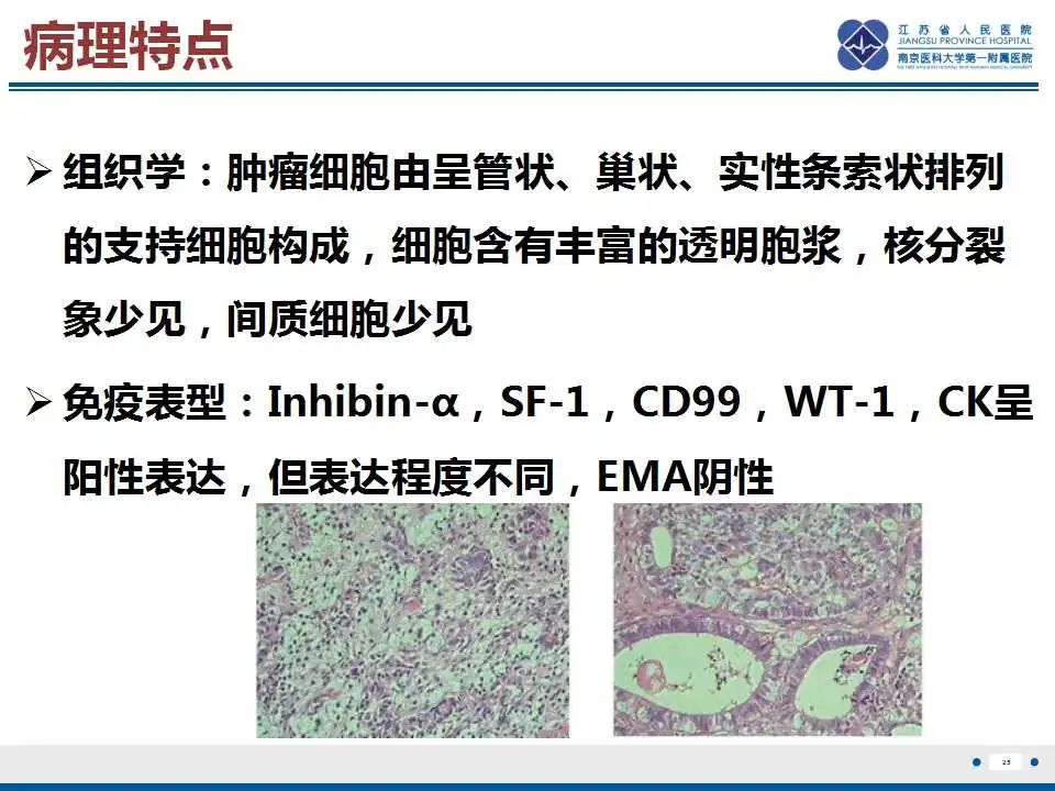 影像PPT - 【PPT】卵巢支持细胞瘤-26
