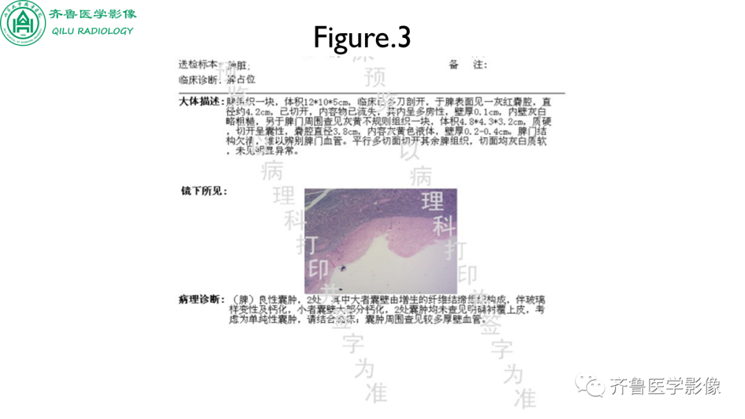 影像PPT - 【PPT】脾脏钙化相关性疾病-6