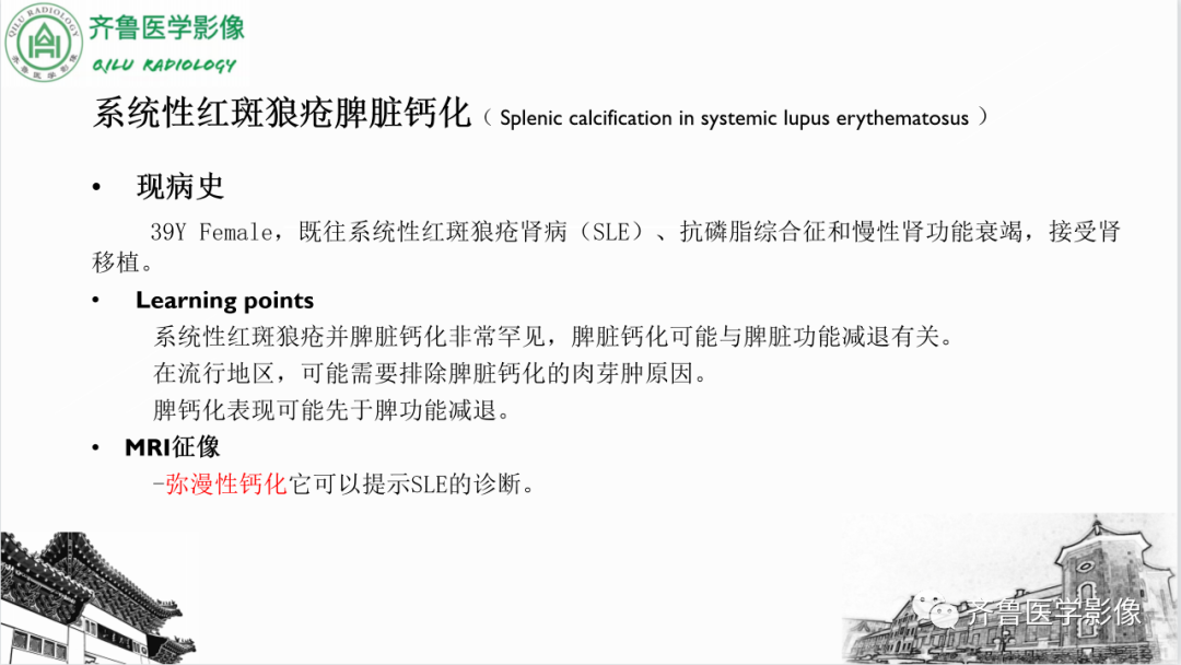 影像PPT - 【PPT】脾脏钙化相关性疾病-30