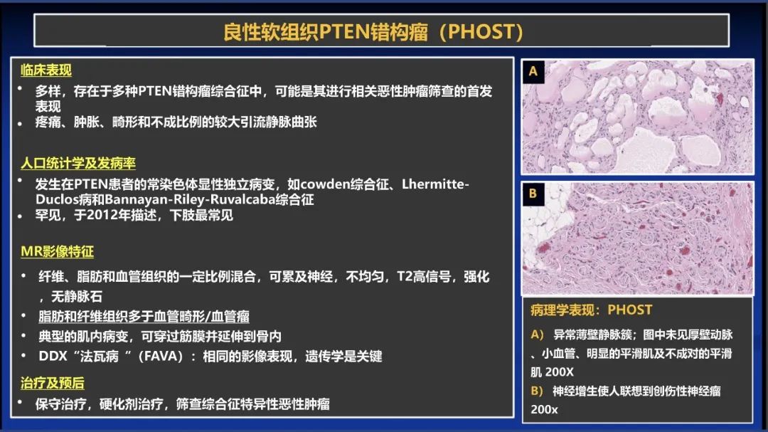 影像PPT - 【PPT】除了神经鞘瘤和神经纤维瘤：与神经相关的良性和恶性病变综述-11