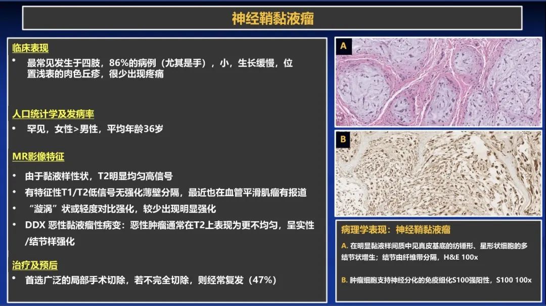 影像PPT - 【PPT】除了神经鞘瘤和神经纤维瘤：与神经相关的良性和恶性病变综述-7