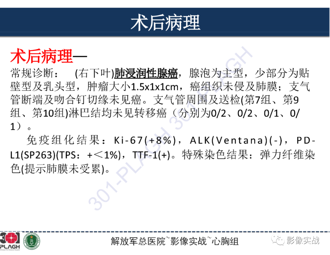 影像PPT - 【病例】肺浸润性腺癌1例CT影像-30
