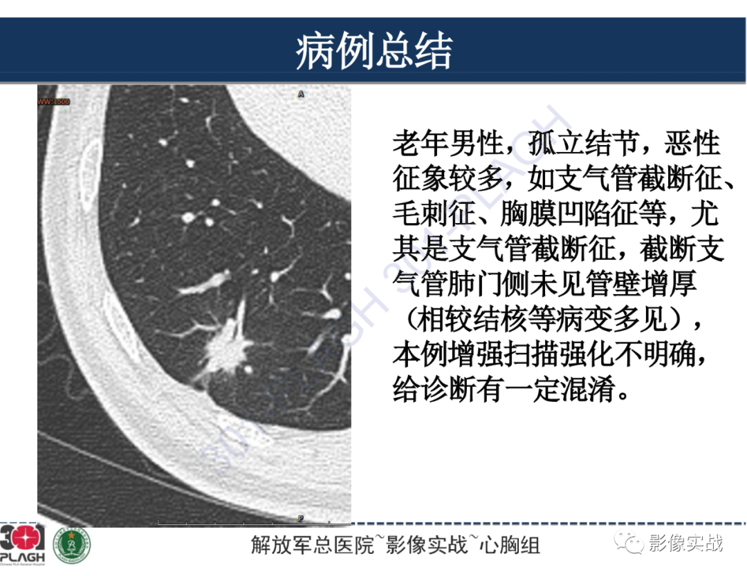 影像PPT - 【病例】肺浸润性腺癌1例CT影像-31