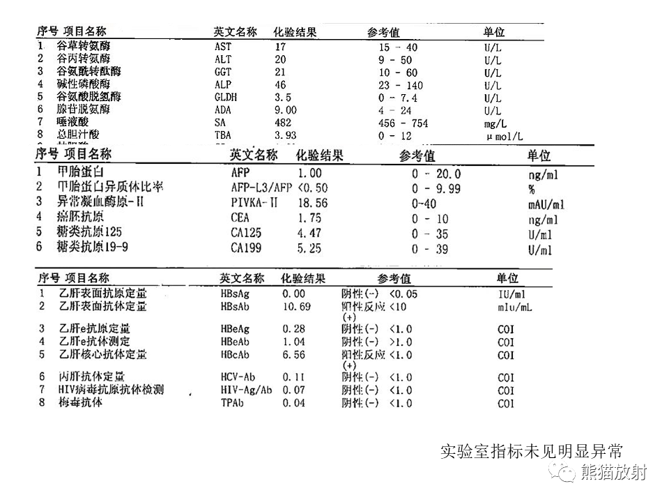 影像PPT - 【病例】肝上皮样血管内皮瘤 VS 海绵状血管瘤-3