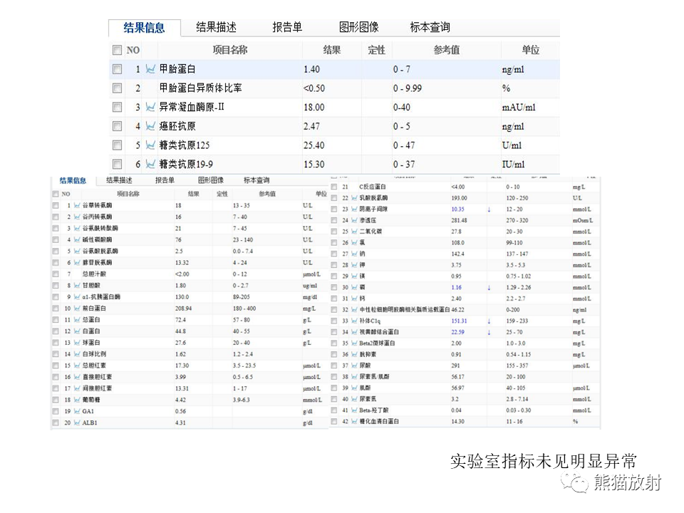 影像PPT - 【病例】肝上皮样血管内皮瘤 VS 海绵状血管瘤-15