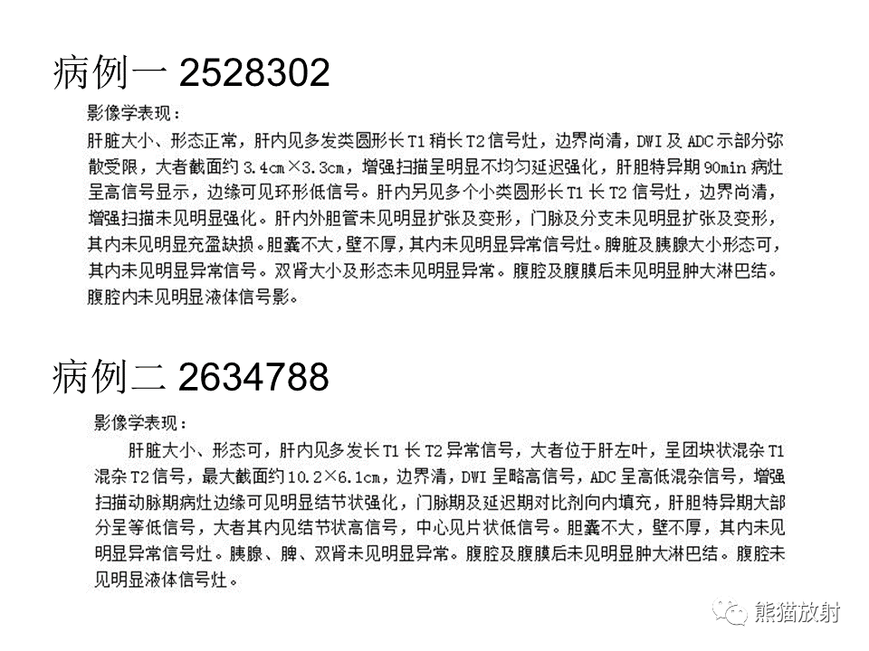 影像PPT - 【病例】肝上皮样血管内皮瘤 VS 海绵状血管瘤-26