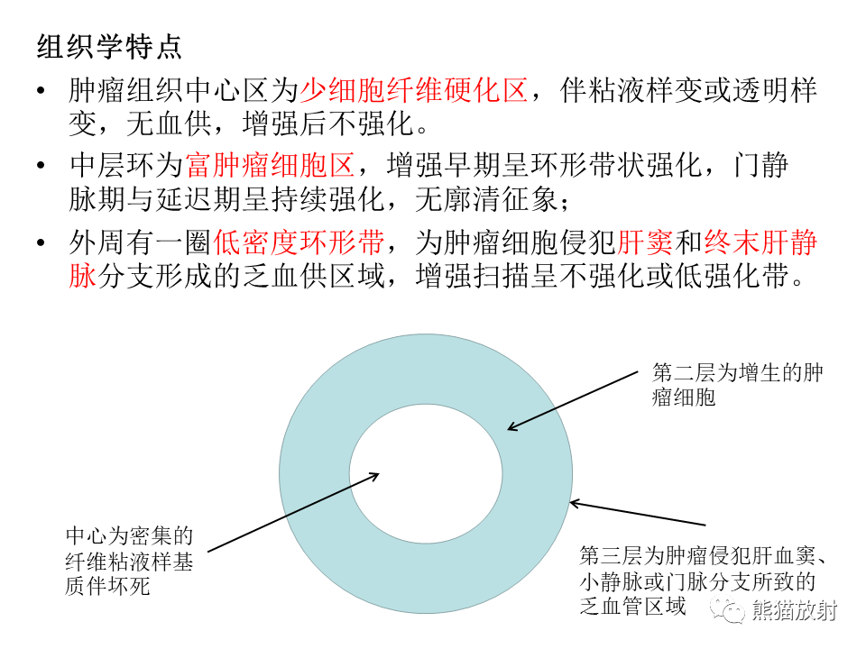 影像PPT - 【病例】肝上皮样血管内皮瘤 VS 海绵状血管瘤-30