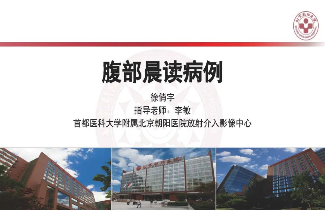 影像PPT - 【PPT】HCC诊断及鉴别诊断-1