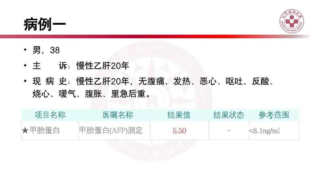 影像PPT - 【PPT】HCC诊断及鉴别诊断-2