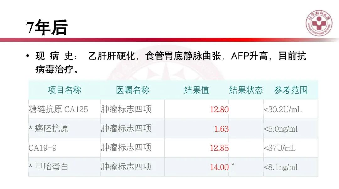 影像PPT - 【PPT】HCC诊断及鉴别诊断-9