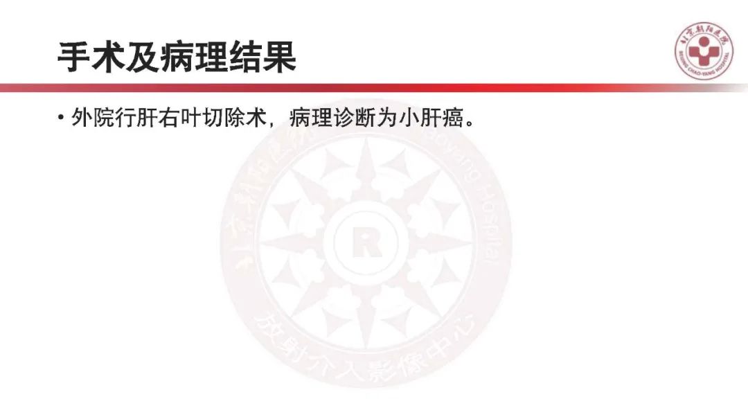 影像PPT - 【PPT】HCC诊断及鉴别诊断-14