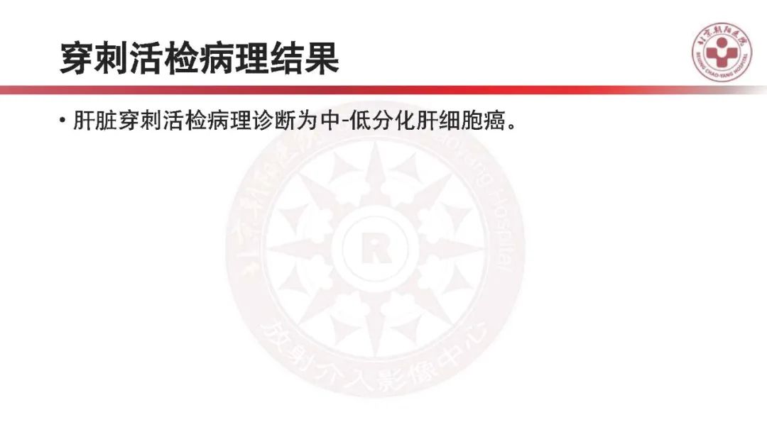 影像PPT - 【PPT】HCC诊断及鉴别诊断-19