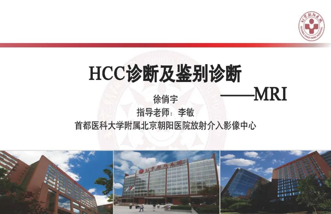 影像PPT - 【PPT】HCC诊断及鉴别诊断-20