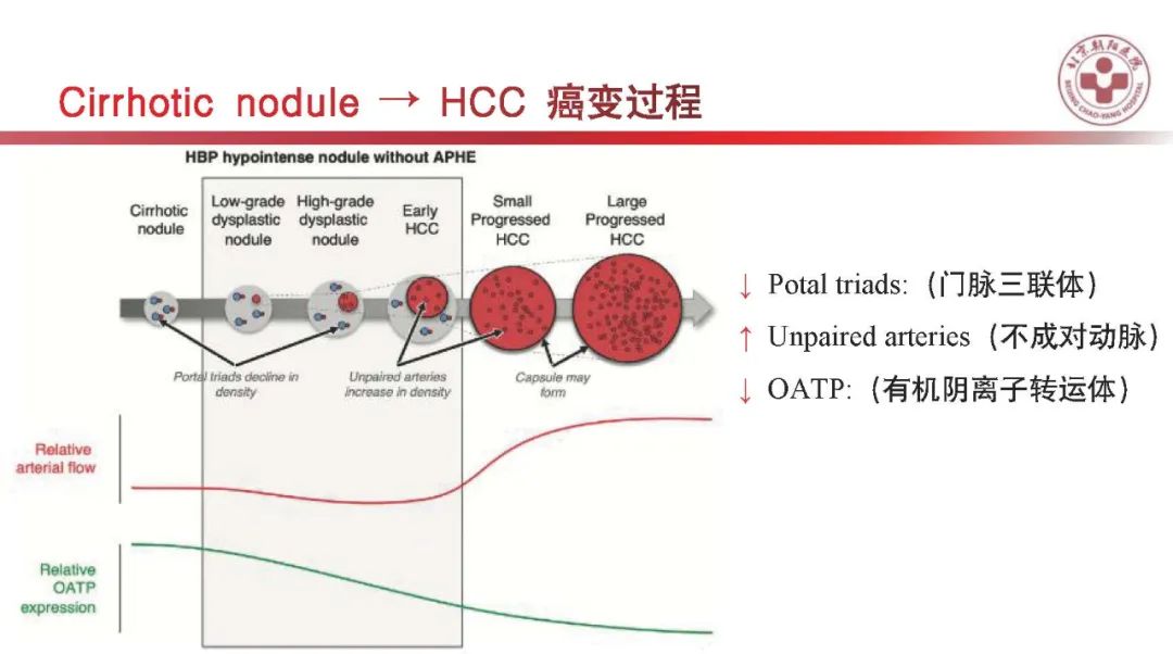 影像PPT - 【PPT】HCC诊断及鉴别诊断-23