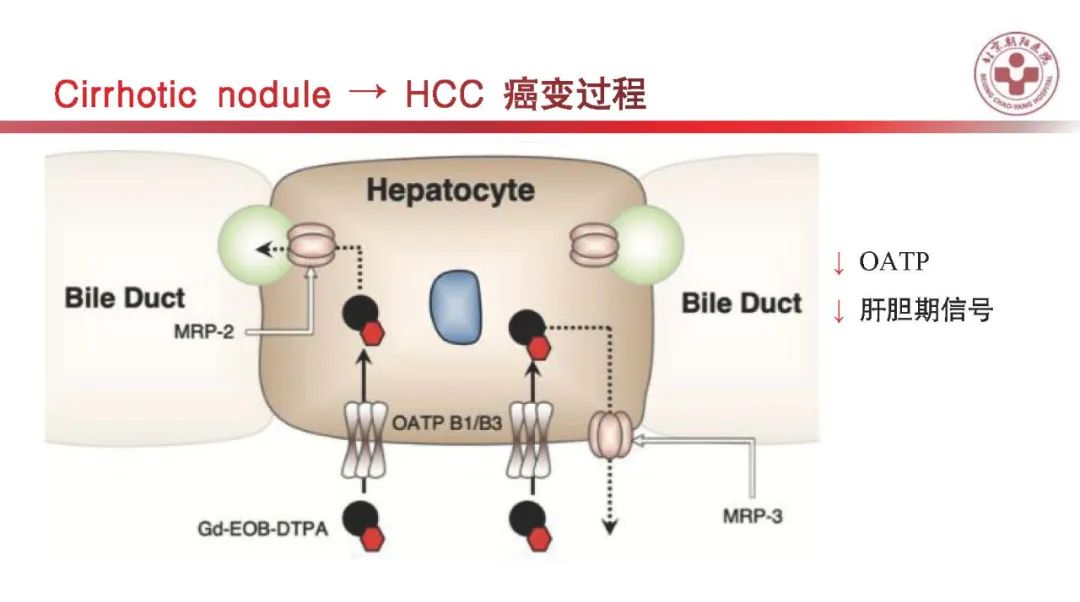影像PPT - 【PPT】HCC诊断及鉴别诊断-24