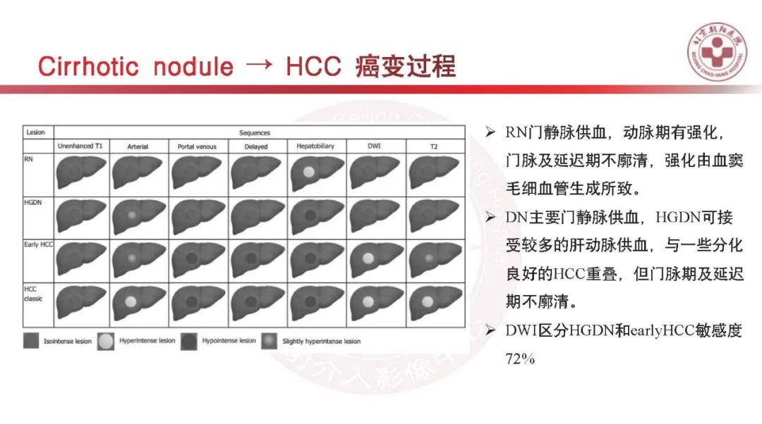 影像PPT - 【PPT】HCC诊断及鉴别诊断-26
