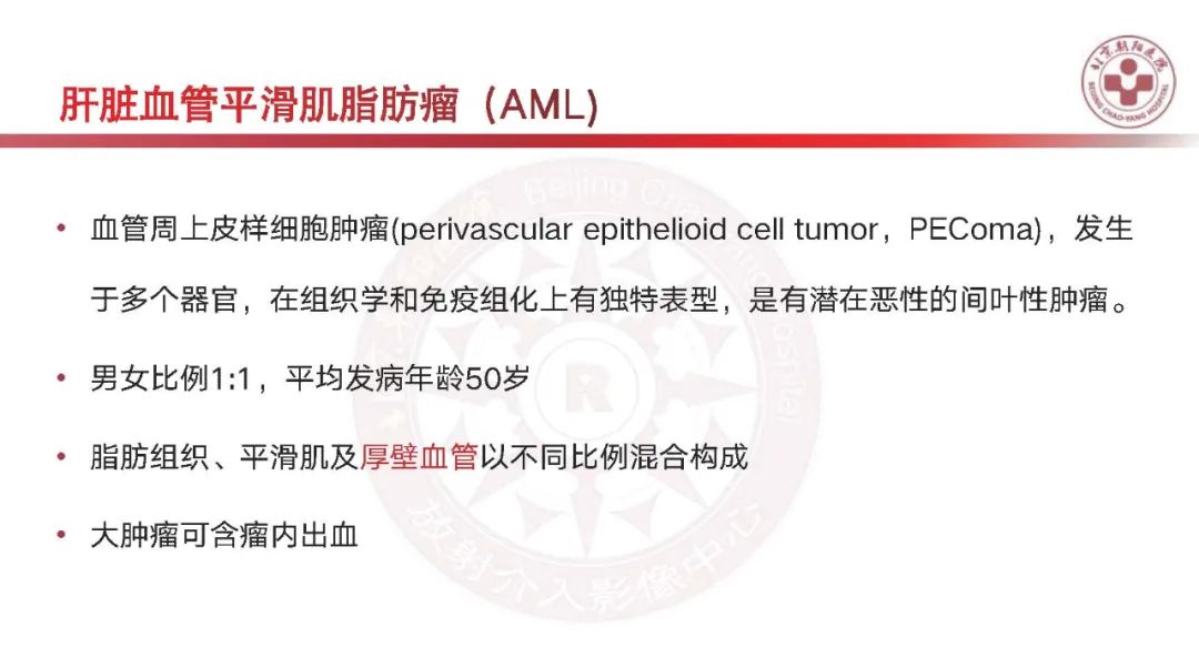 影像PPT - 【PPT】HCC诊断及鉴别诊断-42