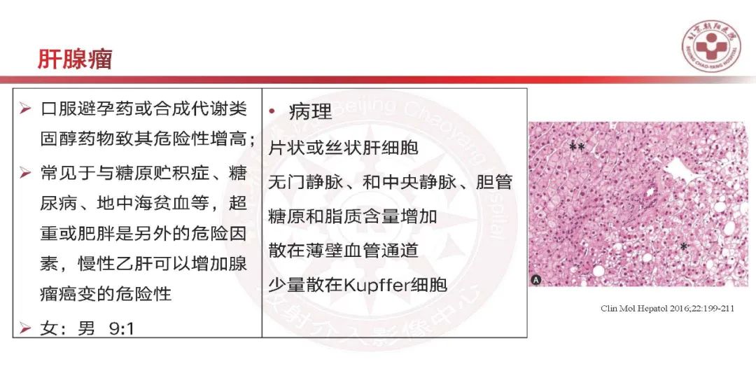 影像PPT - 【PPT】HCC诊断及鉴别诊断-45