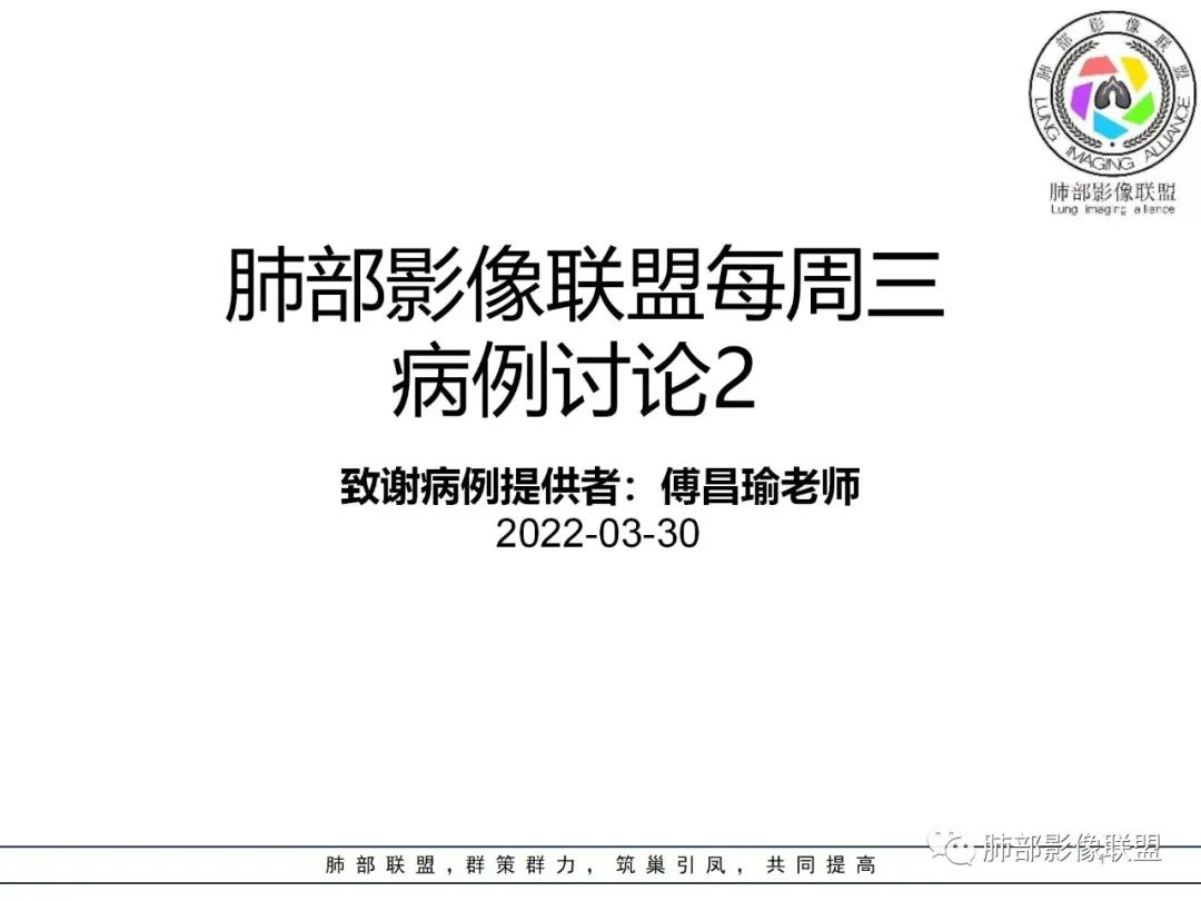 影像PPT - 【病例】肺内孤立性纤维瘤1例CT影像诊断要点-1 影像PPT - 【病例】肺内孤立性纤维瘤1例CT影像诊断要点-1