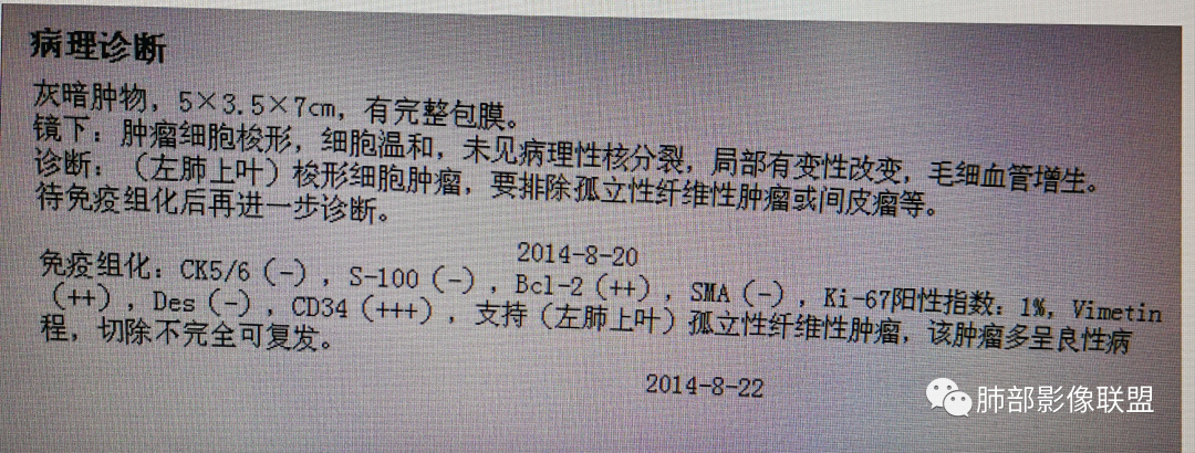 影像PPT - 【病例】肺内孤立性纤维瘤1例CT影像诊断要点-46 影像PPT - 【病例】肺内孤立性纤维瘤1例CT影像诊断要点-46