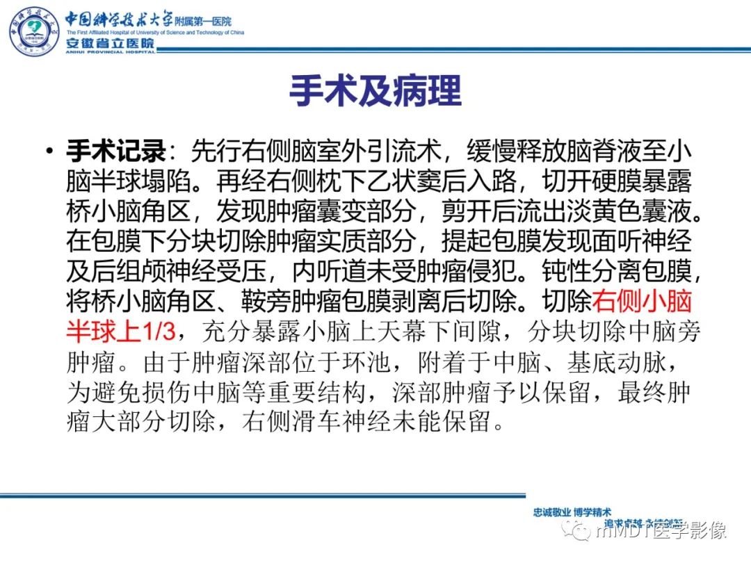 影像PPT - 【PPT】毛细胞型星形细胞瘤病例解析-17