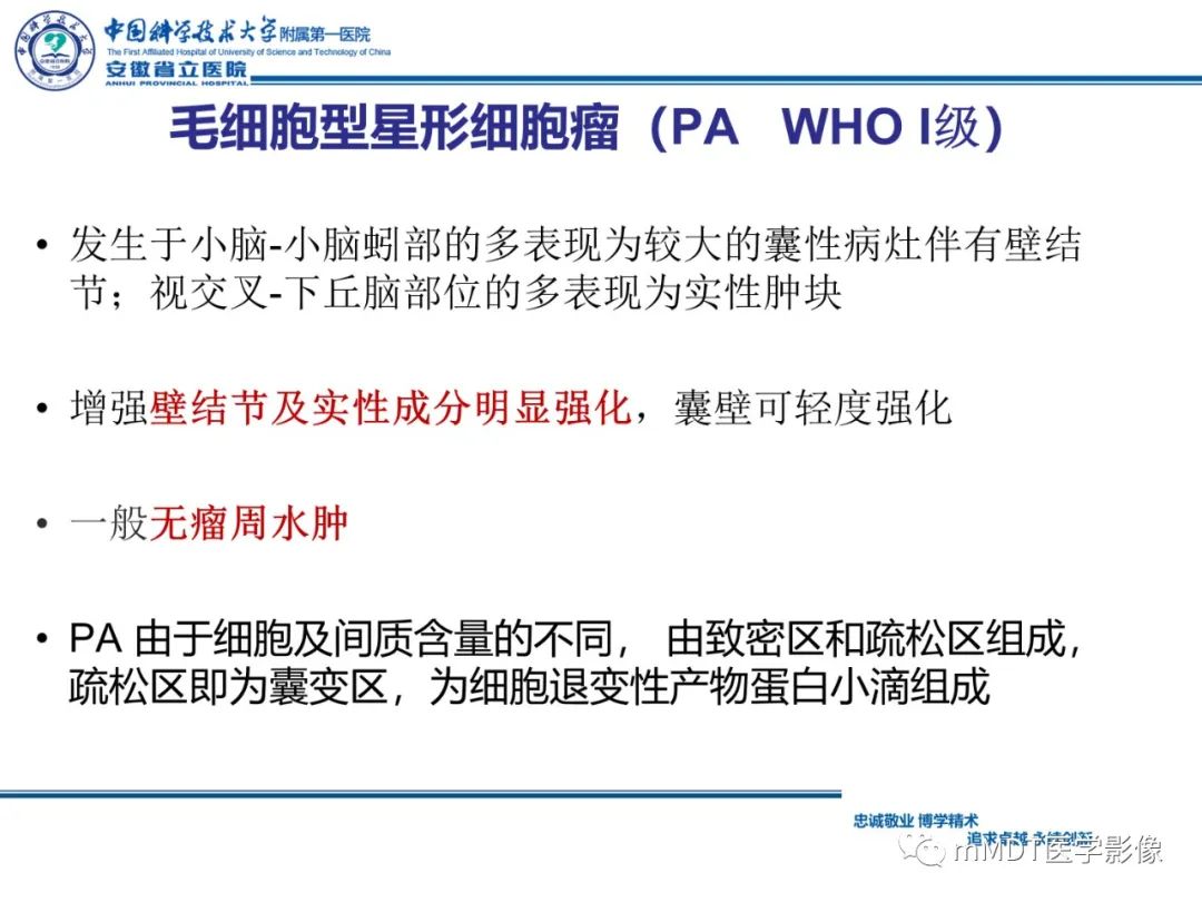影像PPT - 【PPT】毛细胞型星形细胞瘤病例解析-20