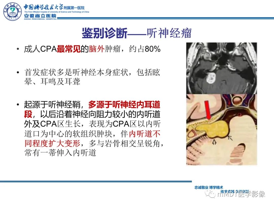 影像PPT - 【PPT】毛细胞型星形细胞瘤病例解析-21