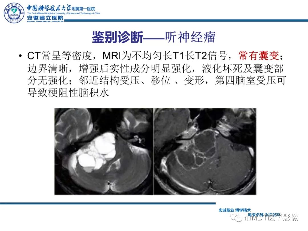 影像PPT - 【PPT】毛细胞型星形细胞瘤病例解析-22