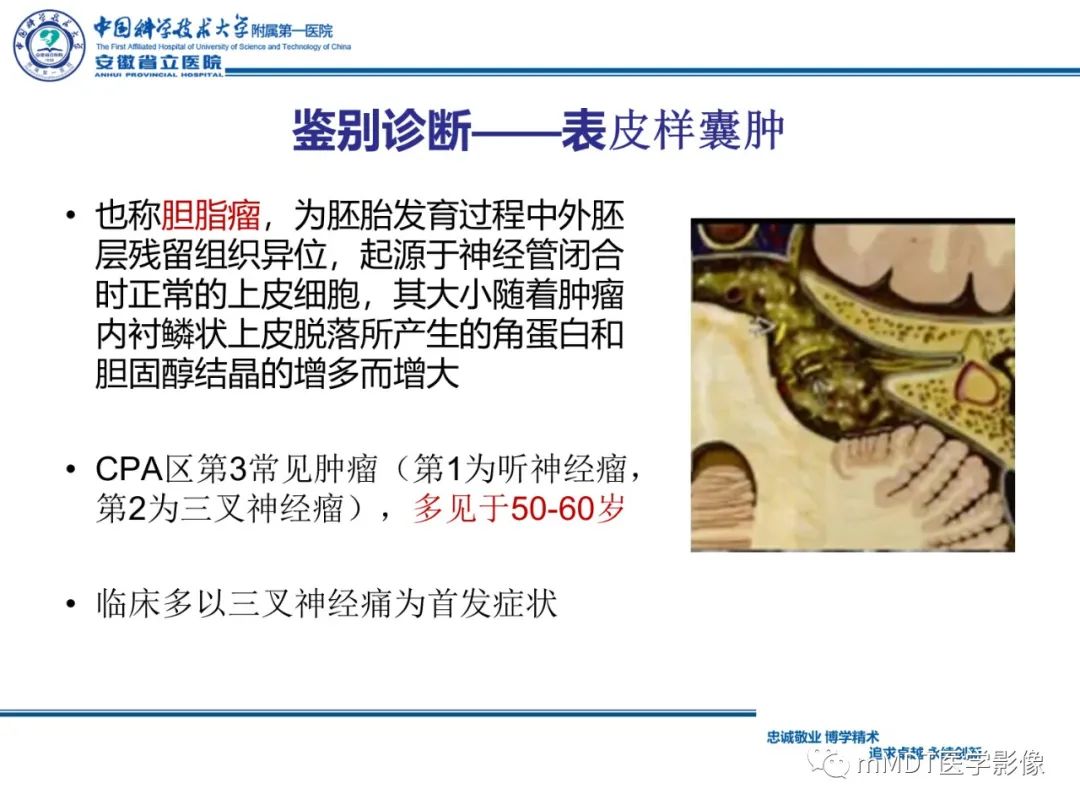 影像PPT - 【PPT】毛细胞型星形细胞瘤病例解析-23