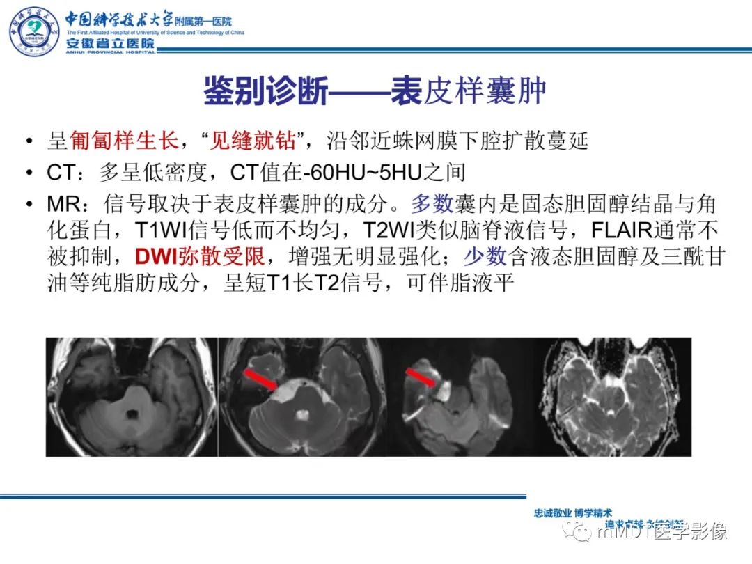 影像PPT - 【PPT】毛细胞型星形细胞瘤病例解析-24