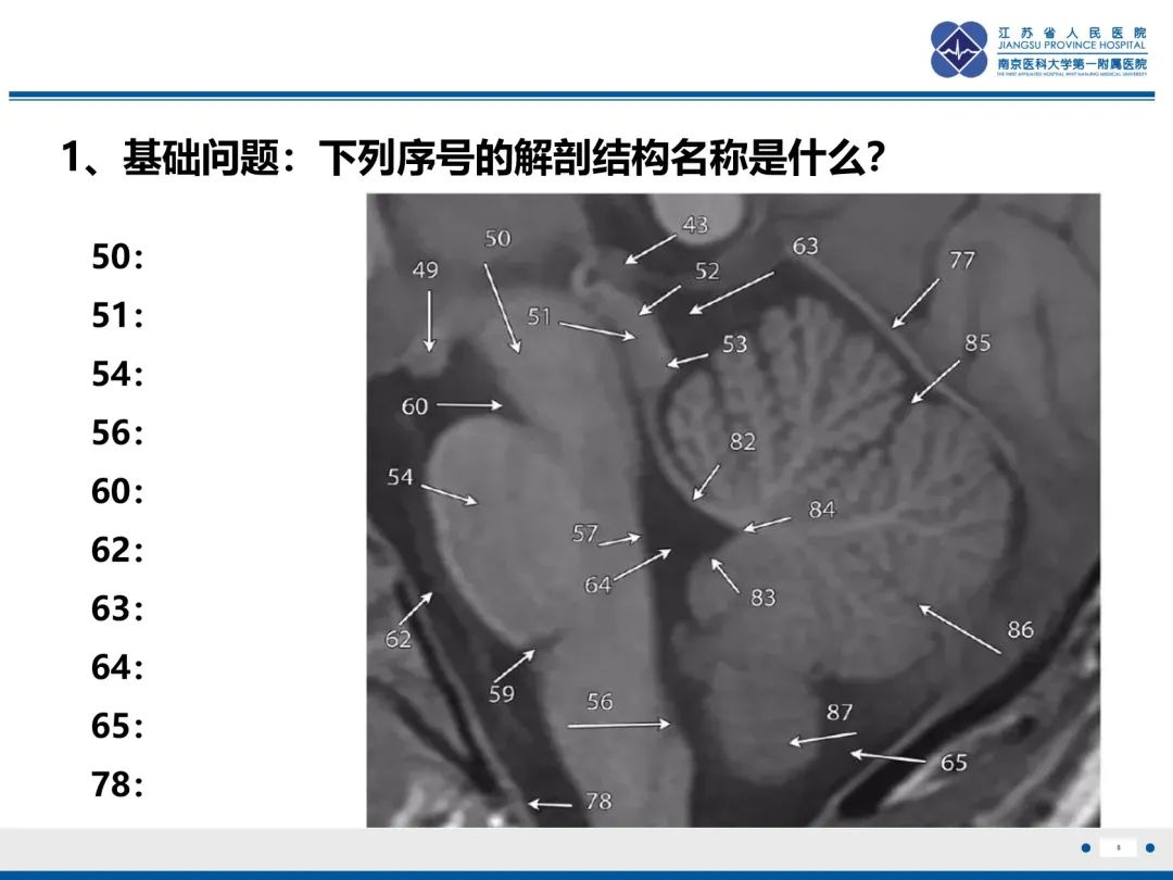 影像PPT - 【PPT】橄榄体脑桥小脑萎缩-9