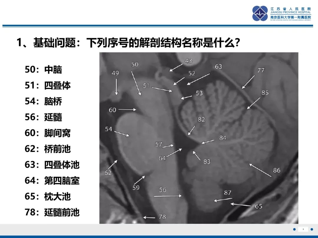 影像PPT - 【PPT】橄榄体脑桥小脑萎缩-10