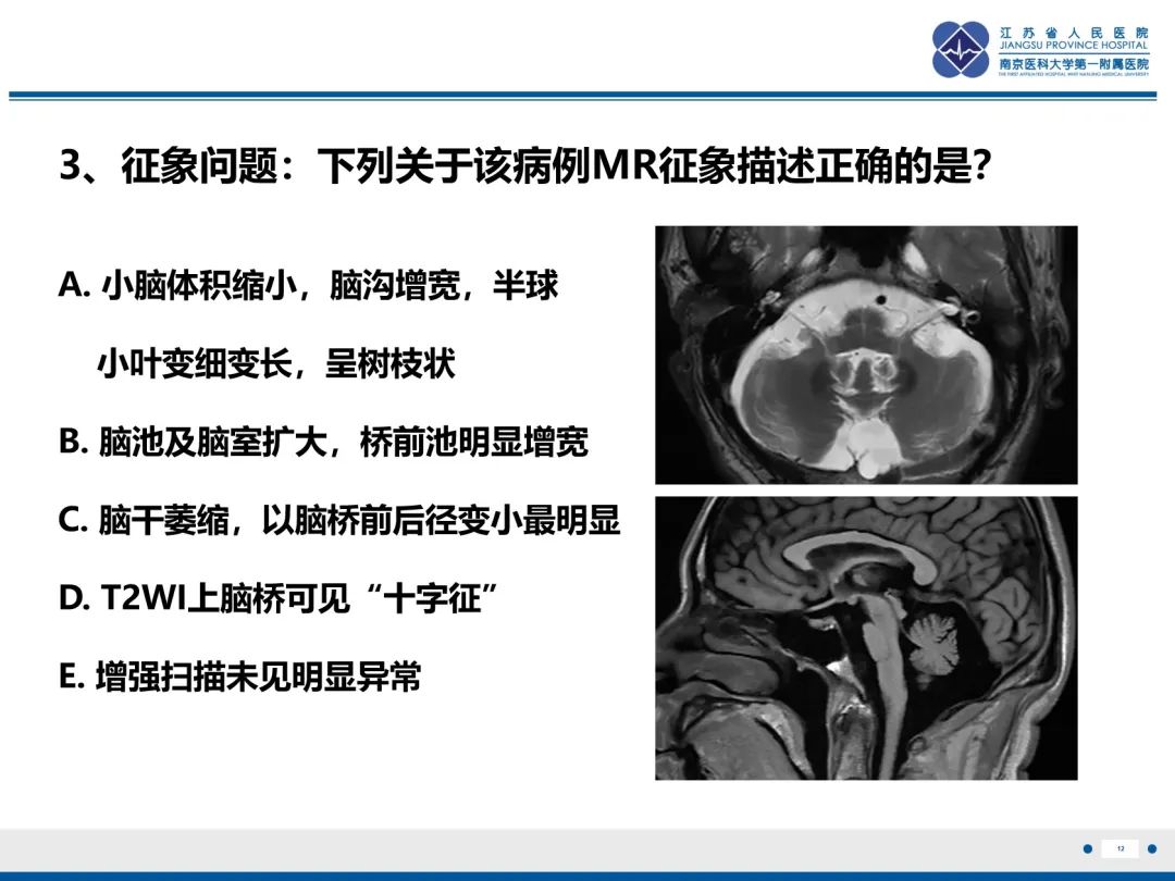影像PPT - 【PPT】橄榄体脑桥小脑萎缩-13