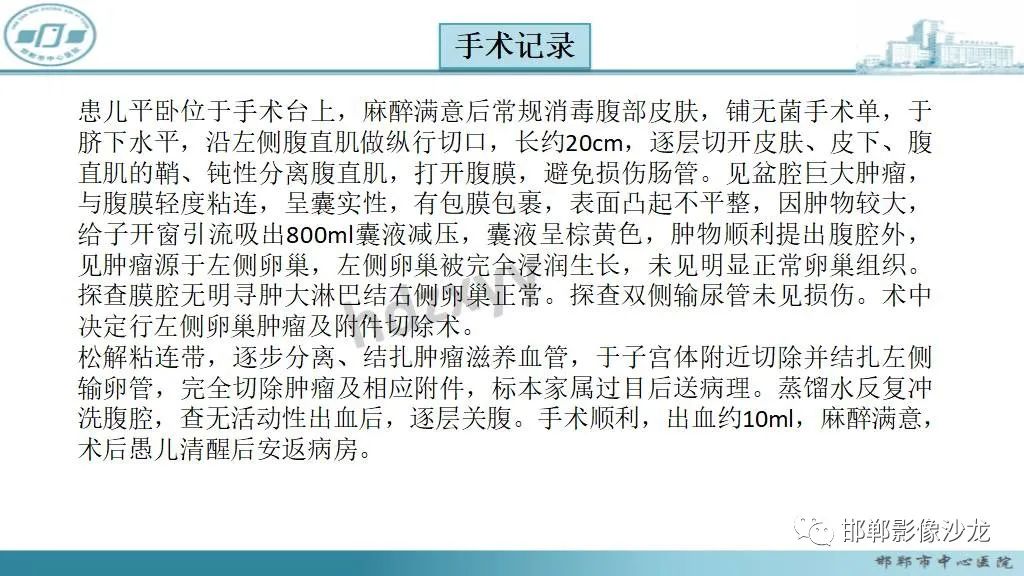 影像PPT - 【PPT】卵巢甲状腺肿-9 影像PPT - 【PPT】卵巢甲状腺肿-9
