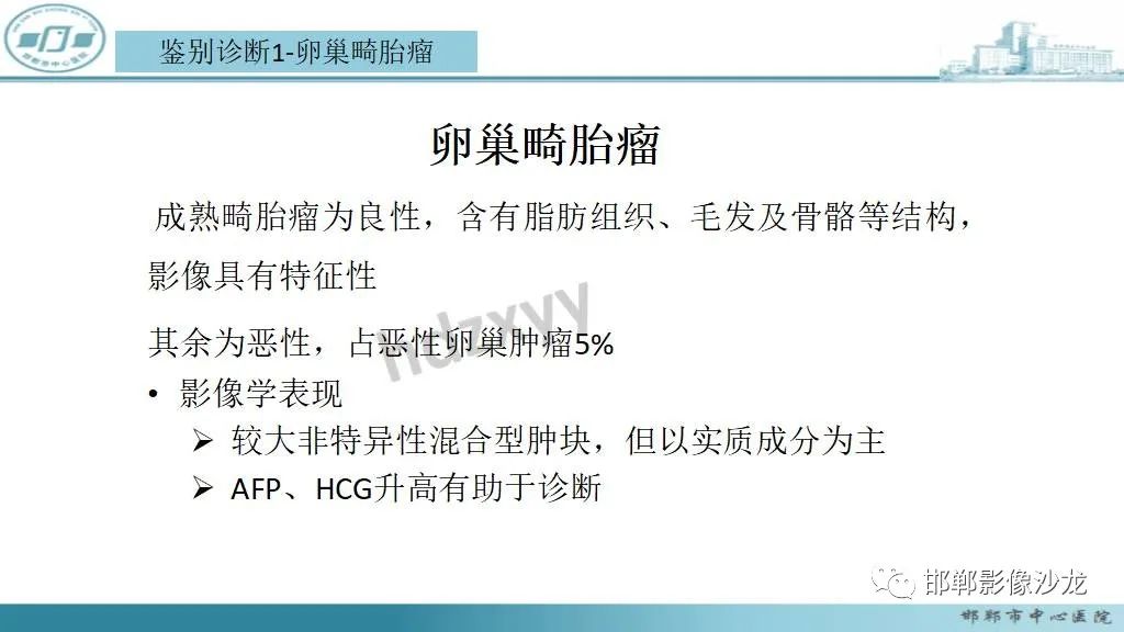影像PPT - 【PPT】卵巢甲状腺肿-23 影像PPT - 【PPT】卵巢甲状腺肿-23