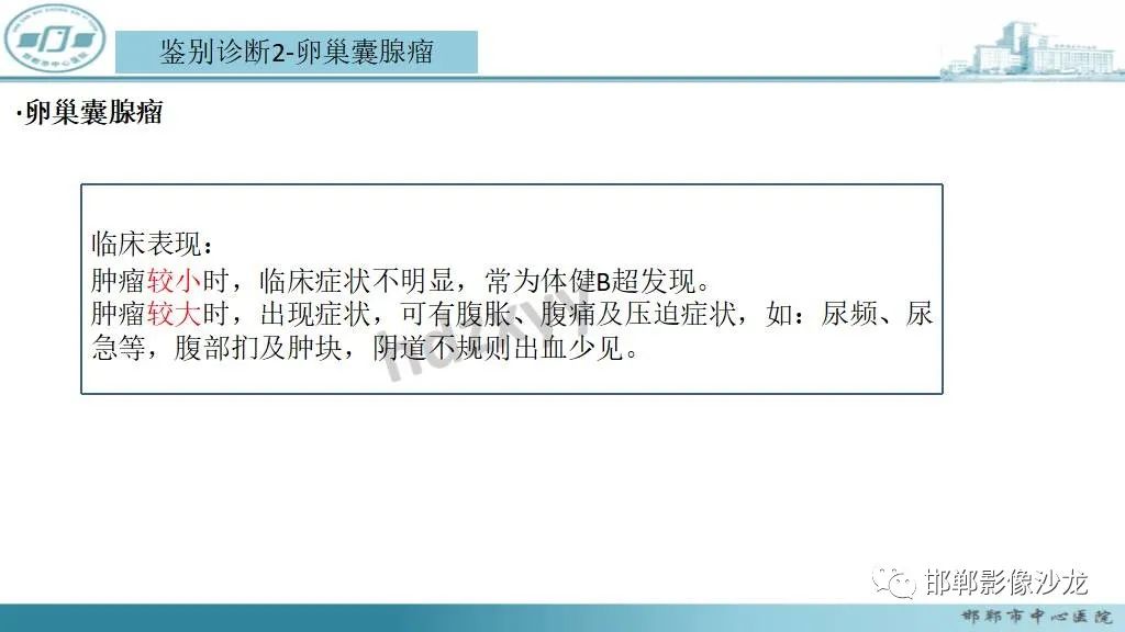 影像PPT - 【PPT】卵巢甲状腺肿-26 影像PPT - 【PPT】卵巢甲状腺肿-26
