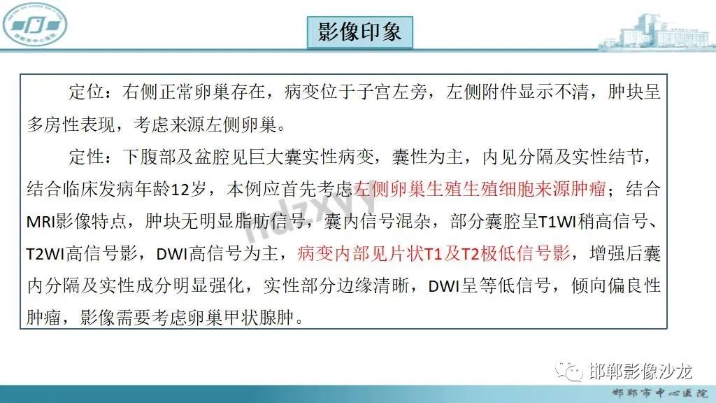 影像PPT - 【PPT】卵巢甲状腺肿-11 影像PPT - 【PPT】卵巢甲状腺肿-11